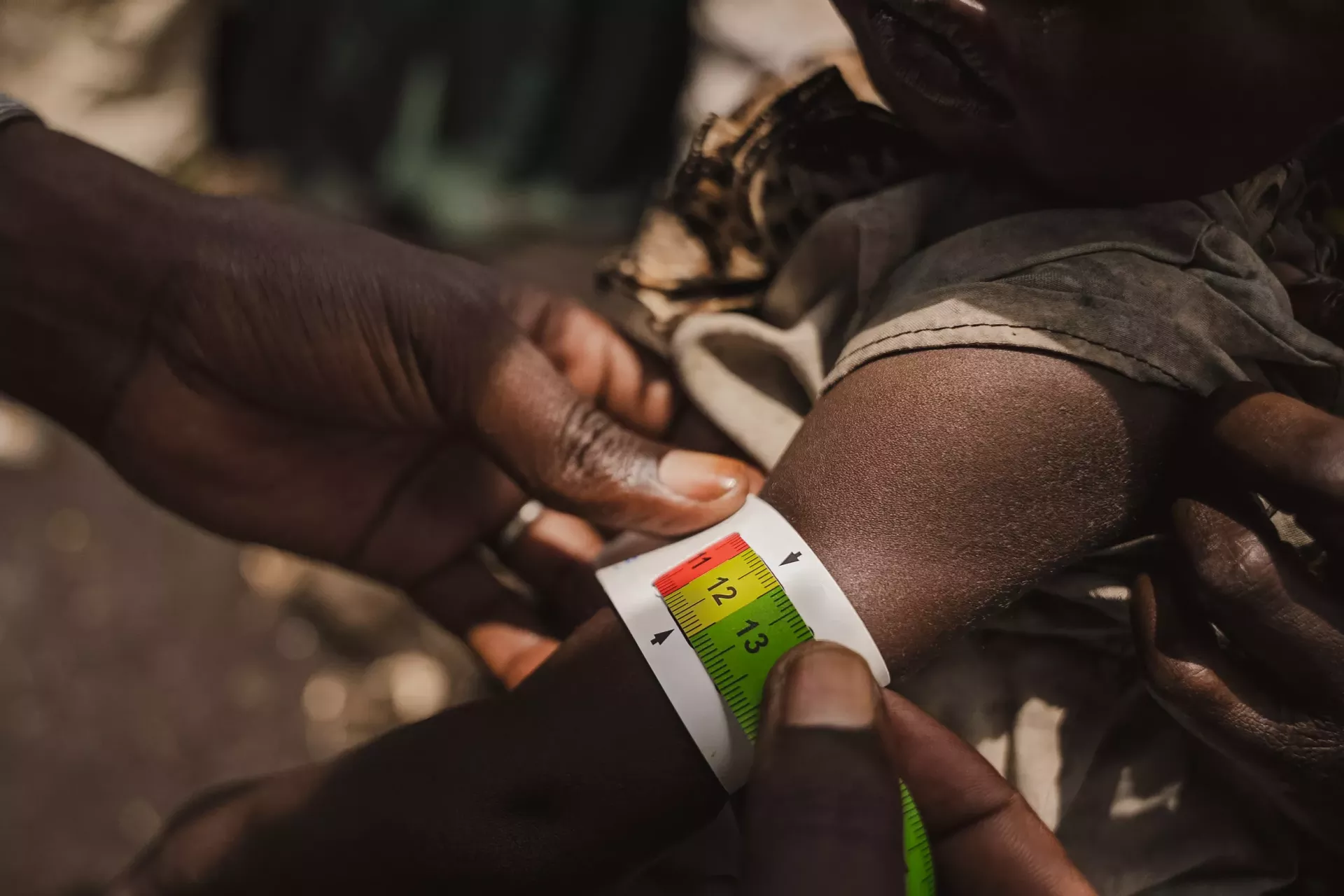 Child's arm being measured
